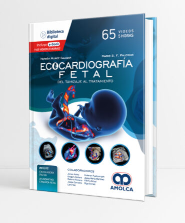Ecocardiografía Fetal 1era edición - Palermo