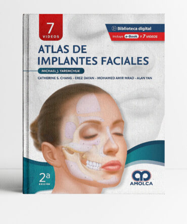 Portada del libro Atlas de implantes faciales 2a edicion