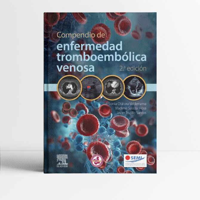 Portada del libro Compendio de Enfermedad Tromboembólica Venosa 2a edicion - Otarola