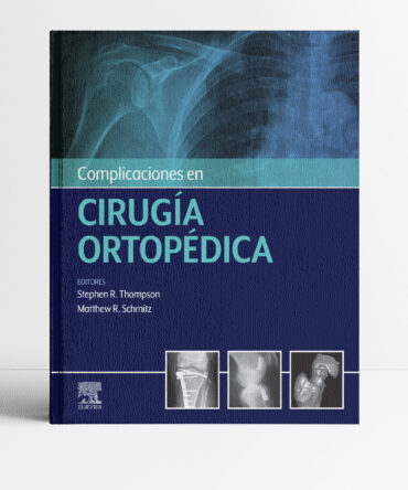 Portada del libro Complicaciones en Cirugía Ortopédica 1era edicón