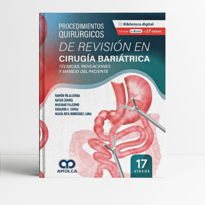Portada de libro Procedimientos Quirúrgicos de Revisión en Cirugía Bariátrica