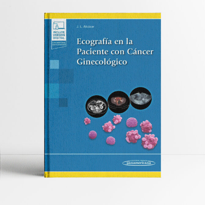 Portada del libro Ecografía en la Paciente con Cáncer Ginecológico 1era edición