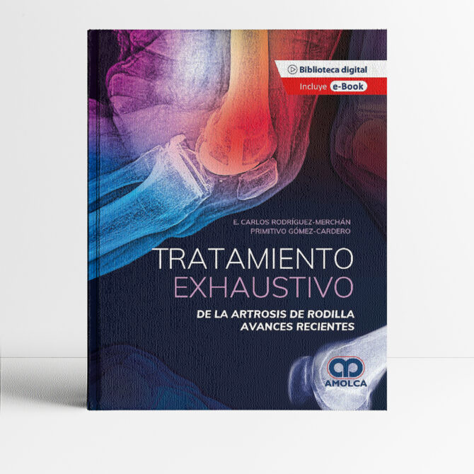 Portada del libro Tratamiento exhaustivo de la artrosis de rodilla 1era edición