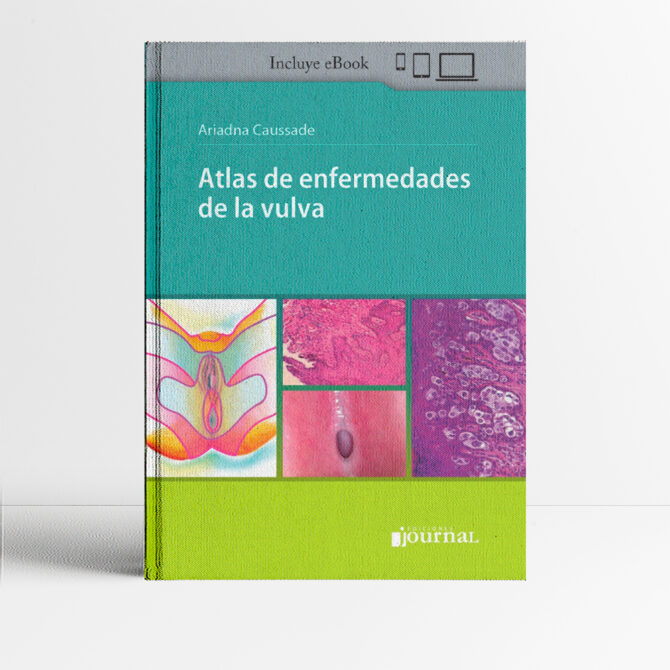 Portada del libro Atlas de Enfermedades de la Vulva 1era edición