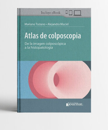 Portada del libro Atlas de colposcopia - Toziano