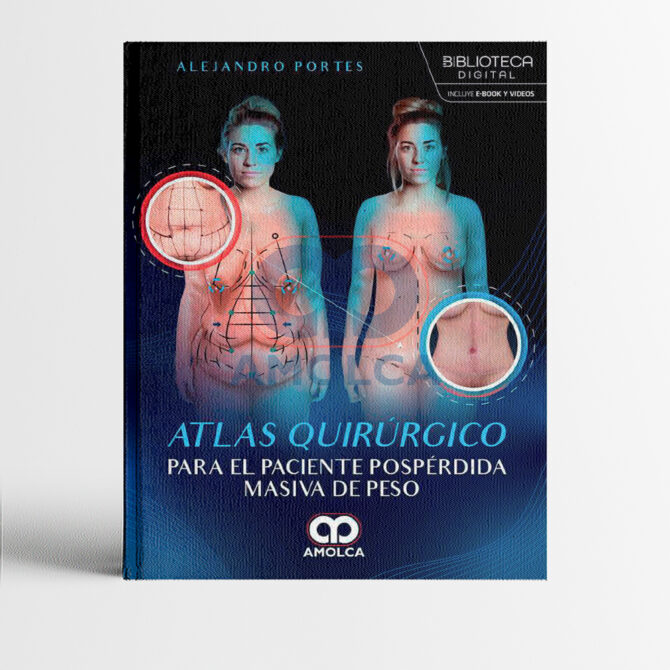 Portada del libro Atlas quirúrgico para el paciente pospérdida masiva de peso 1era edición