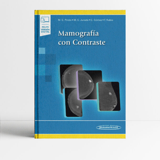 Portada del libro Mamografia con contraste - Prieto