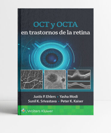 Portada del libro OCT y OCTA en trastornos de la retina