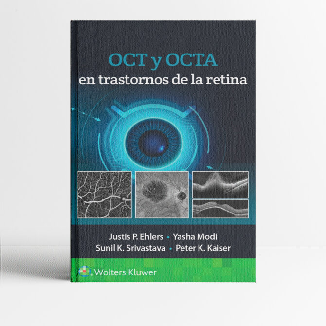 Portada del libro OCT y OCTA en trastornos de la retina