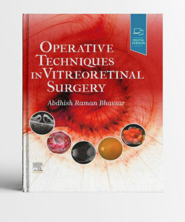 Portada del libro Operative Techniques in Vitreoretinal Surgery