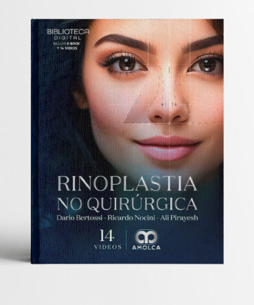 Portada del libro Rinoplastia no quirúrgica - Bertosi