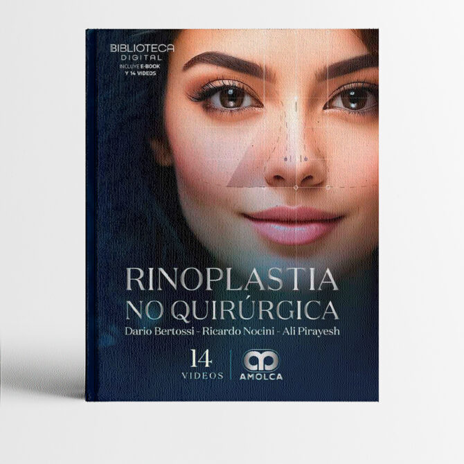 Portada del libro Rinoplastia no quirúrgica - Bertosi