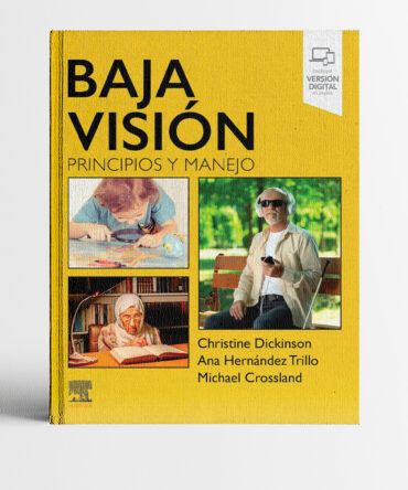Portada del libro Baja visión Principios y Manejo – Christine Dickinson, Elsevier, oftalmología