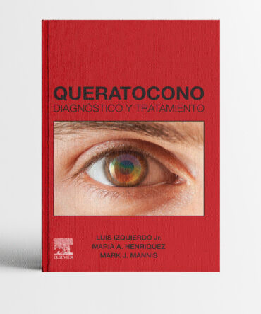 Portada del libro Queratocono Diagnóstico y Tratamiento - Luis Izquierdo - Oftalmología