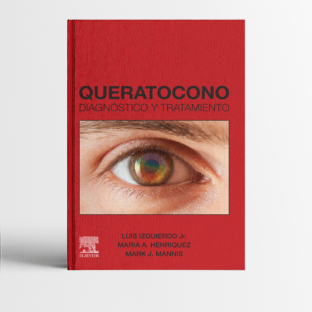 Portada del libro Queratocono Diagnóstico y Tratamiento - Luis Izquierdo - Oftalmología