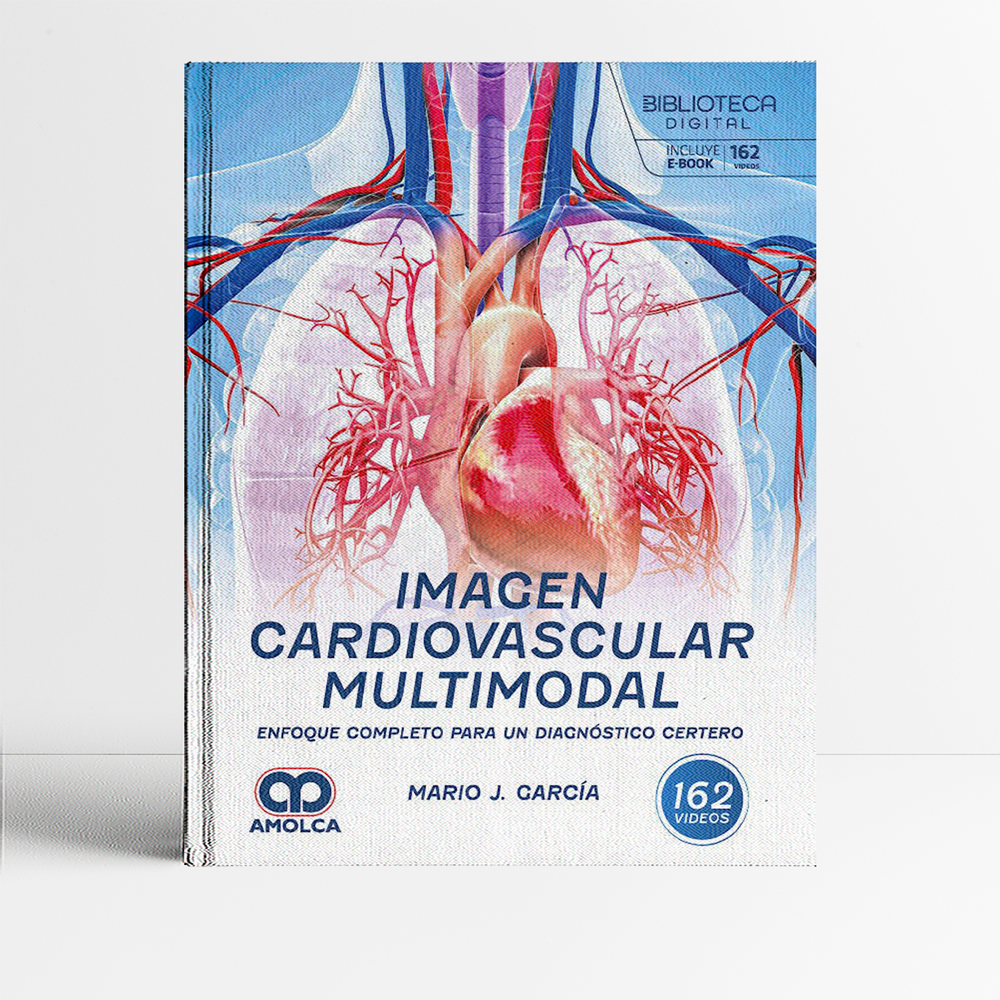 Portada del libro Imagen cardiovascular multimodal - Garcia